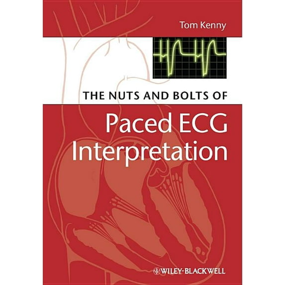 Nuts and Bolts Series (Replaced by 5113): The Nuts and Bolts of Paced ECG Interpretation (Paperback)