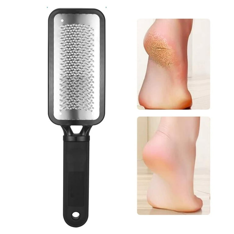 Keyohome Callus Remover, Stainless Steel Foot File for Cracked