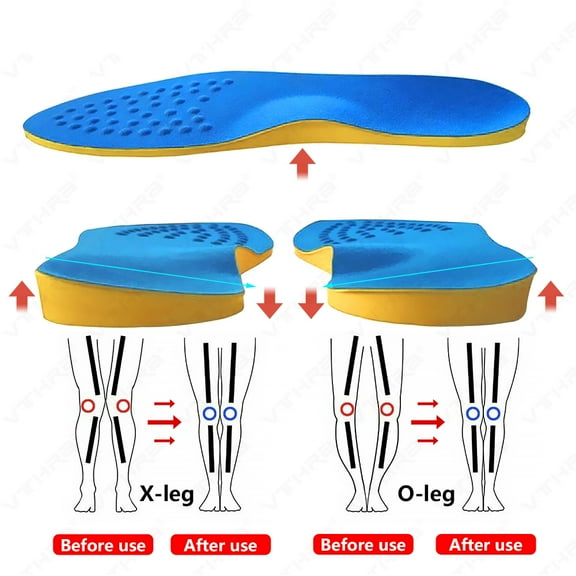 O/X Leg Orthopedic Insoles Correction Shoes Inserts For Foot Alignment Knock Knee Pain Bow Valgus Varus Feet Care Cushions