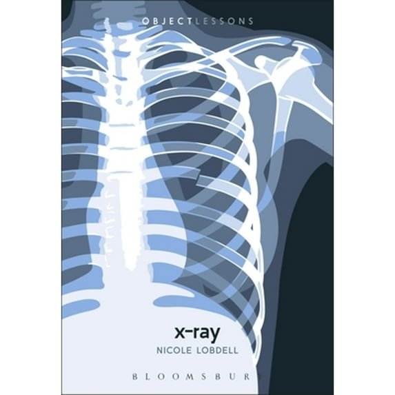 Pre-Owned X-Ray (Paperback) 1501386700 9781501386701