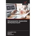 thumbnail image 1 of Obrazowanie implantÃ³w dentystycznych, (Paperback), 1 of 1