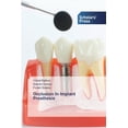 thumbnail image 1 of Occlusion In Implant Prosthesis (Paperback), 1 of 1