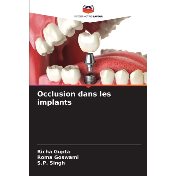 Occlusion dans les implants, (Paperback)