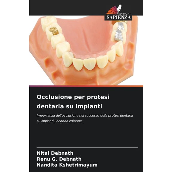 Occlusione per protesi dentaria su impianti, (Paperback)