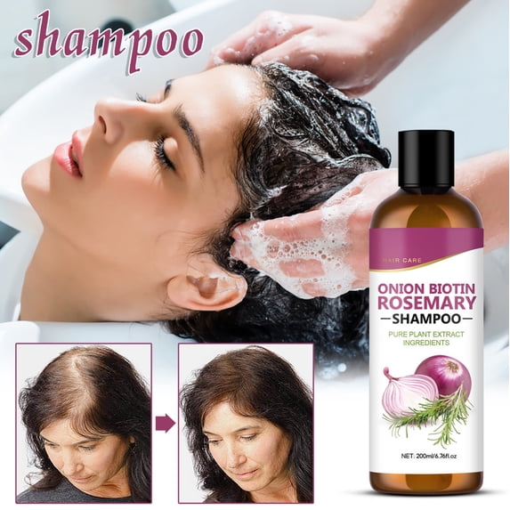 Onions Biotin Olive Extract Shampoo Deeply Moisturizing For Dry Hair Suitable For Both Men And Women 200ml