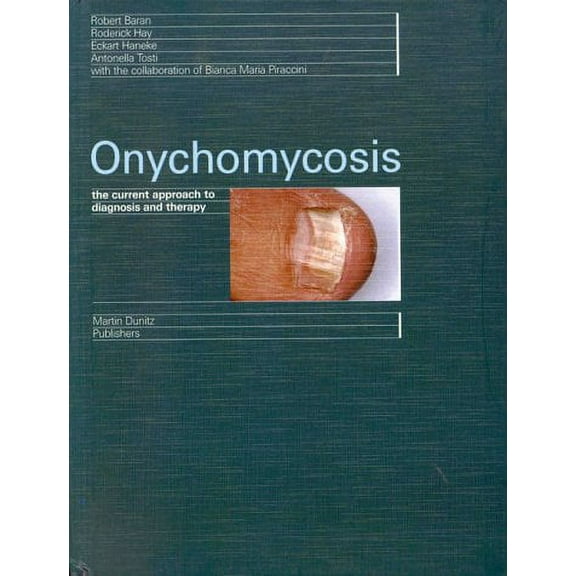 Pre-Owned Onychomycosis: The Current Approach to Diagnosis and Therapy (Hardcover) 1853177679 9781853177675