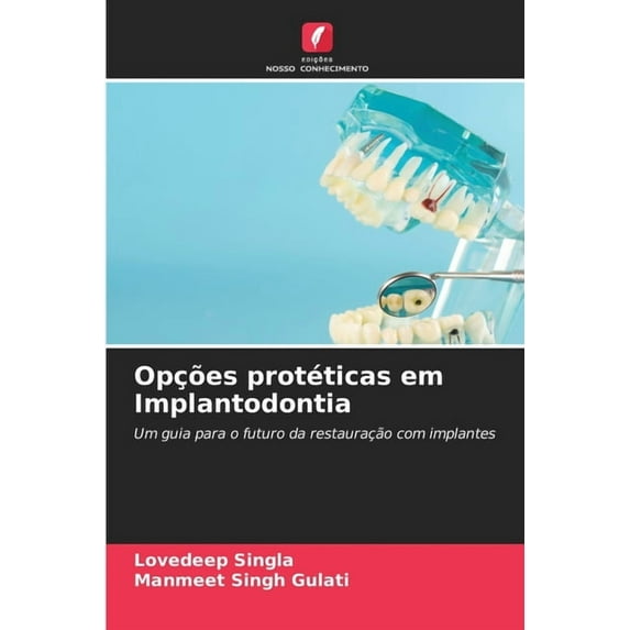 Opções protéticas em Implantodontia, (Paperback)