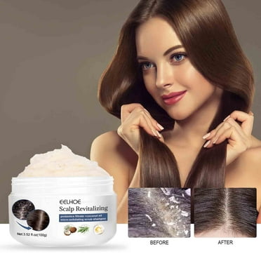 Openpig Scalp Scrub, Scalp Exfoliator, Scalp Exfoliator Scrub for Build Up, Hair Exfoliate Scrub for Scalp, Hair Treatment Nourishing Detox Hair Care with Scalp Massager