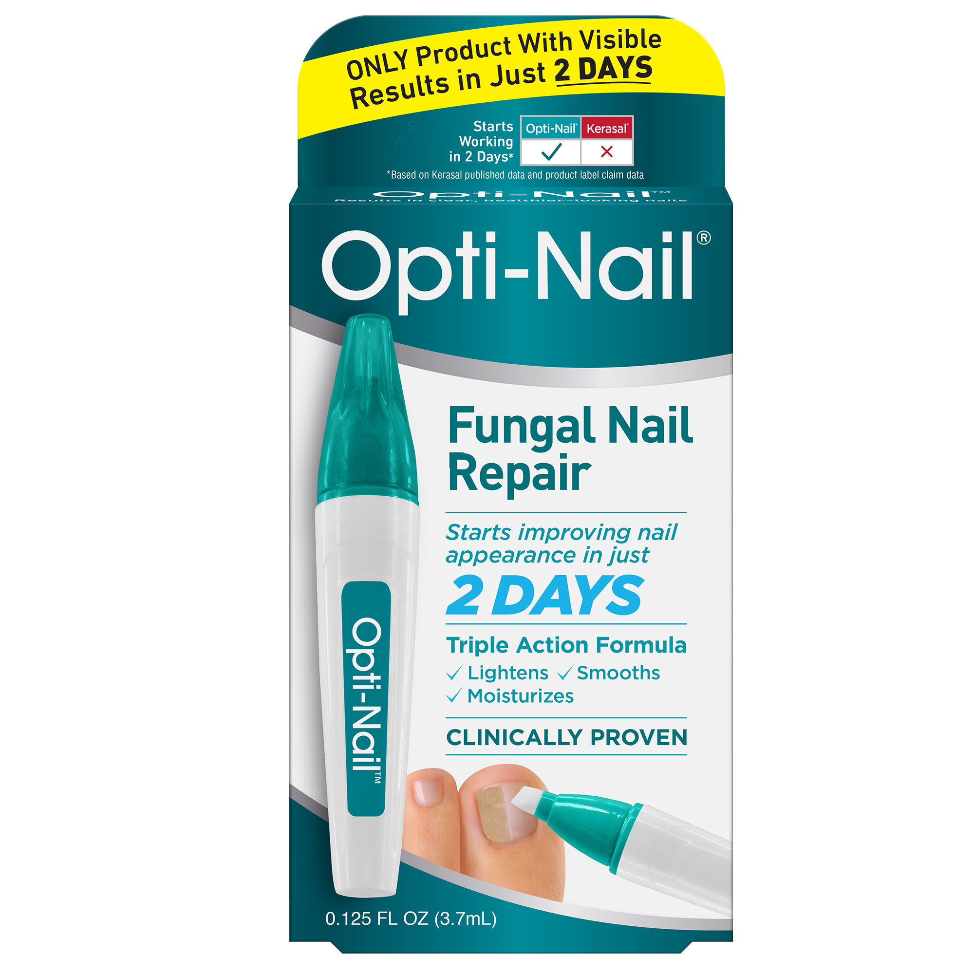 Opti Nail Fungal Nail Repair Pen Restores The Healthy Appearance Of 
