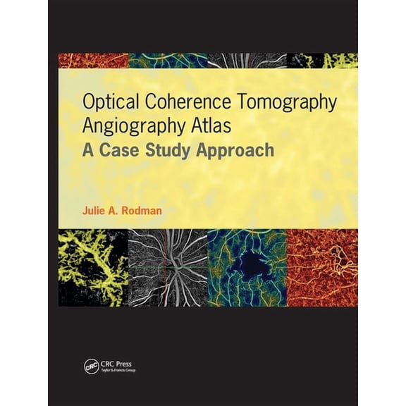 Optical Coherence Tomography Angiography Atlas: A Case Study Approach, (Hardcover)
