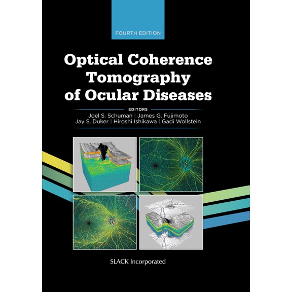 Optical Coherence Tomography of Ocular Diseases (Edition 4) (Hardcover)
