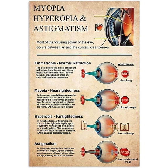 Optometrist Knowledge Aluminum Metal Signs Retro Myopia Hyperopia & Astigmatism Poster Hospital Office Decor Optical Shop Home Infographic Classroom Wall Decor Plaque Signs 8x12 inches