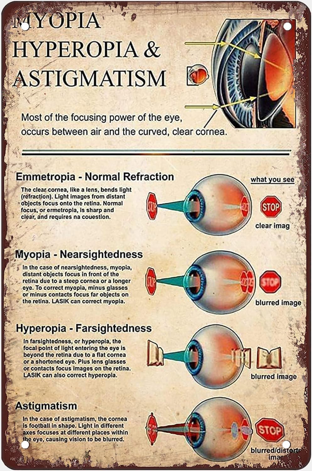 Optometrist Knowledge Metal Tin Sign Retro Wall Decor Myopia Hyperopia ...