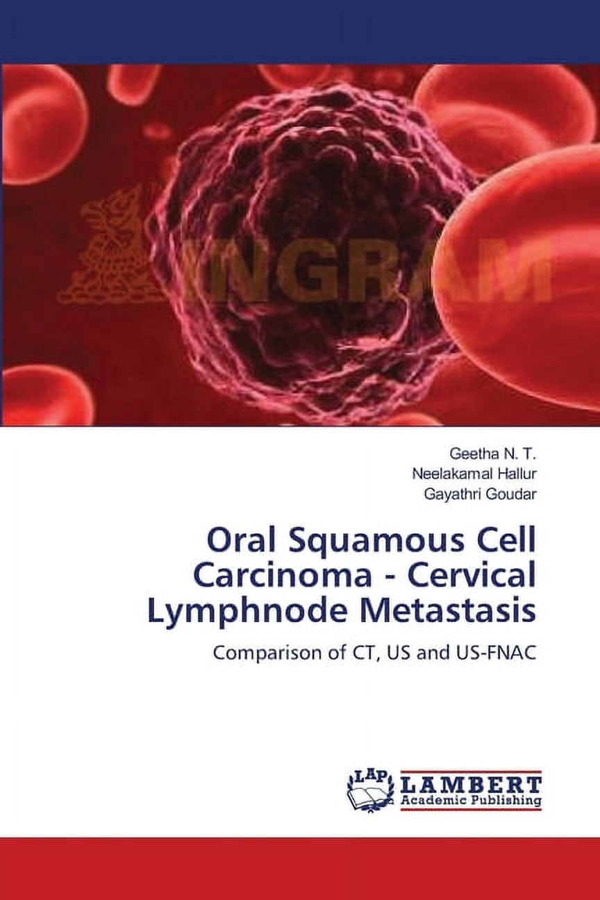Oral Squamous Cell Carcinoma - Cervical Lymphnode Metastasis (Paperback ...