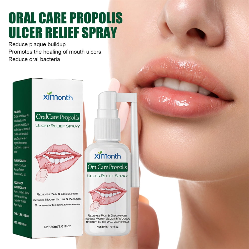 Oral Ulcer Relief Spray Relieves Oral Gum Swelling And Pain, Dry And