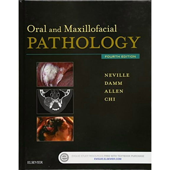 Oral and Maxillofacial Pathology (Edition 4) (Hardcover)