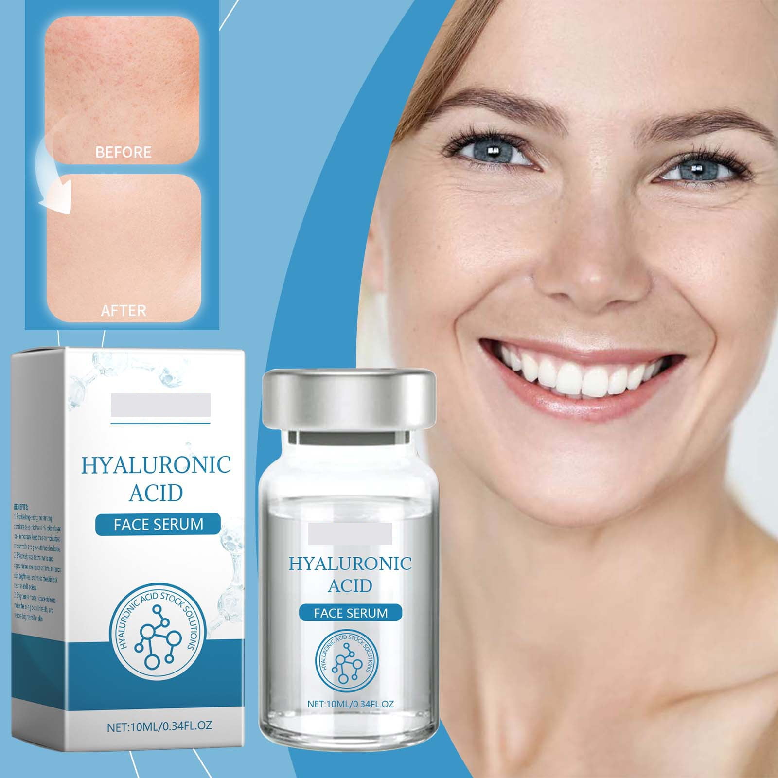 Ordinary Skin Glowing Its Skin 10 Lip Line H Yaluronic A Cid Face S