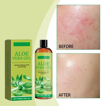 Organic Aloe Vera Gel from freshly cut 100% Pure Aloe - Big 3.38oz - HighestQuality, Vegan, Unscented - For Face, Skin, Hair, Sunburn relief