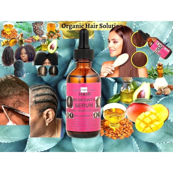 Organic Hair Solution -Edge growth Serum-Oil- Scalp & Hair Strengthening -For Stronger, Thicker Longer Hair-for Split Ends and Dry Scalp- Peppermint-Avocado-Castor-Tea Tree-(2oz