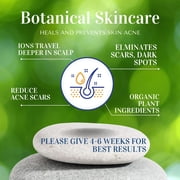 Organic Life Scalp-Care Serum   Gentle Herbal Anti-Dandruff Formula, 4 fl oz