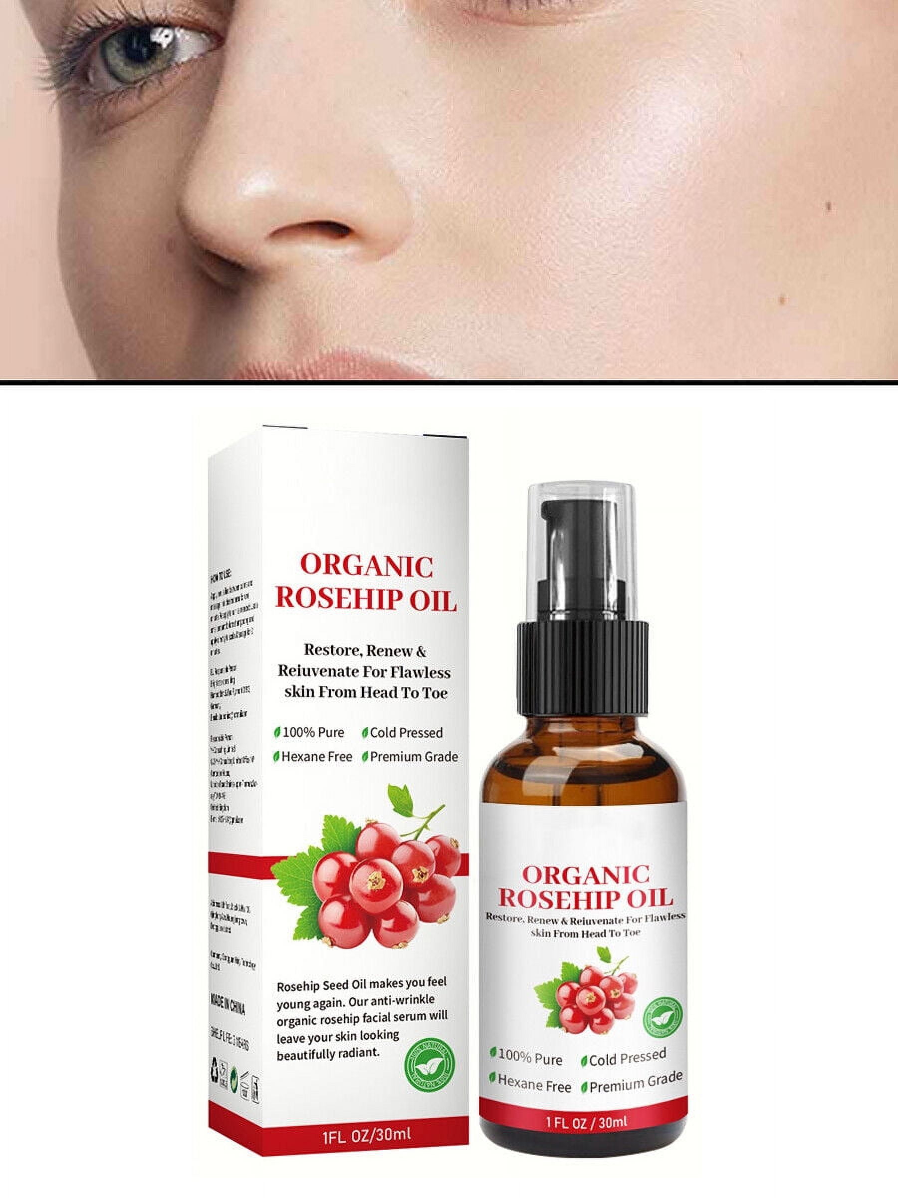 Rosehip Brightening Serum 30 Ml – Mit Hagebuttenöl, Vitamin C & E, Für Strahlende Und Aufgehellte Haut, Natürliche Formel