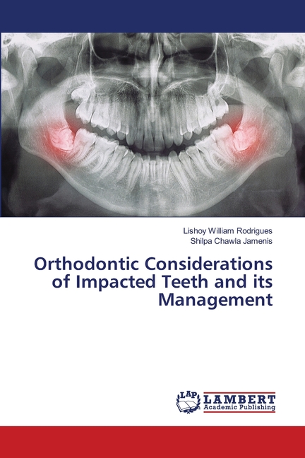 Orthodontic Considerations of Impacted Teeth and its Management ...