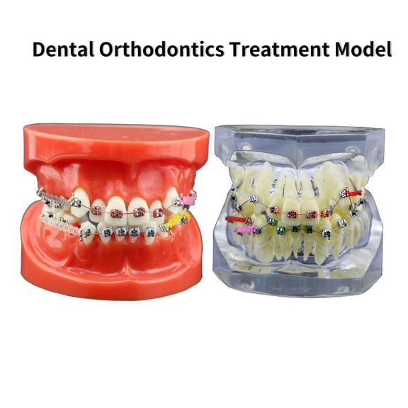 Orthodontic Dental Training Model with Metal Brackets, Arch Wires, Ties, and Chains for Practice