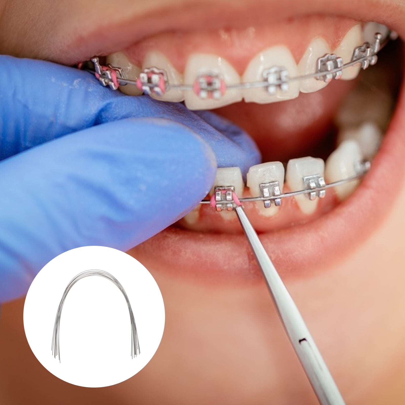 Orthodontic Wires 1 Bag 10pcs Niti Super Elastic Hyperelastic Nickel