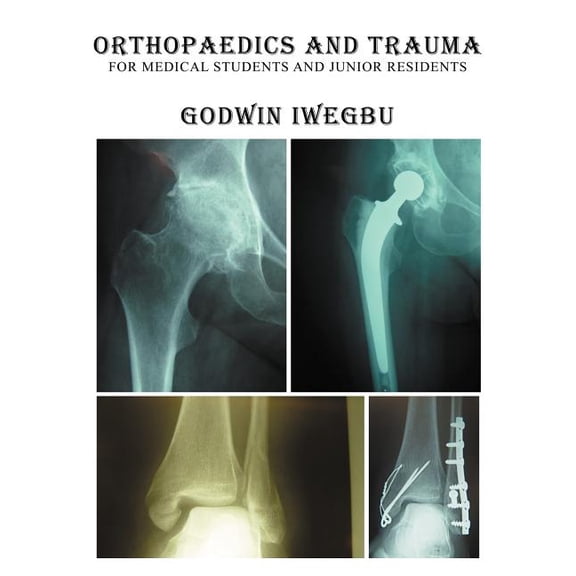 Orthopaedics and Trauma for Medical Students and Junior Residents, (Paperback)