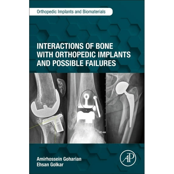 Orthopedic Implants and Biomaterials Interactions of Bone with Orthopedic Implants and Possible Failures, (Paperback)