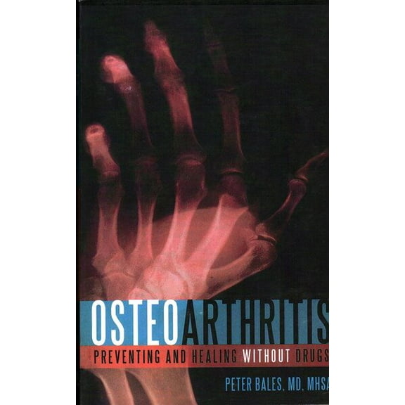 Osteoarthritis : Preventing and Healing Without Drugs (Paperback)