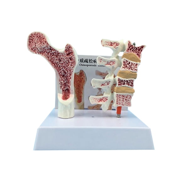 Human Anatomical Osteoporosia Model Vertebrae Anatomical Skeleton Model for Classrooms Clinics Patient Education