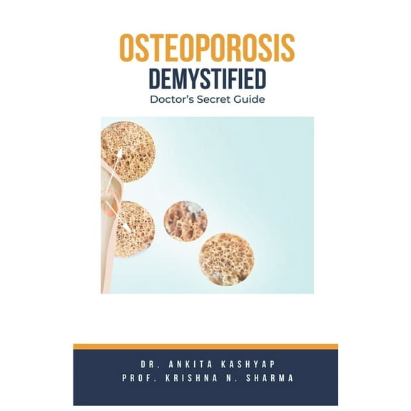 Osteoporosis Demystified: Doctor's Secret Guide, (Paperback)