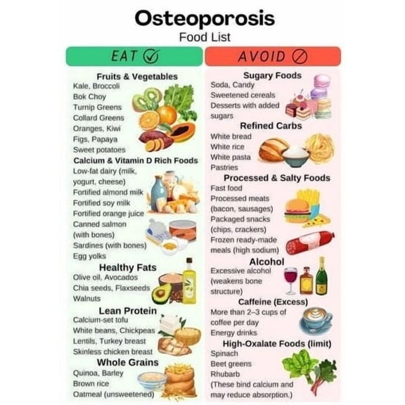 Osteoporosis Food Chart poster High Calcium Food List, High Calcium Grocery List, Calcium Rich Food Chart, Osteoporosis Food List poster