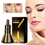 OugPiStiyk Refinement Melanin Vanish Serum Melanin Correcting Facial SerumFacial Serum 30ml, Beauty & Personal Care