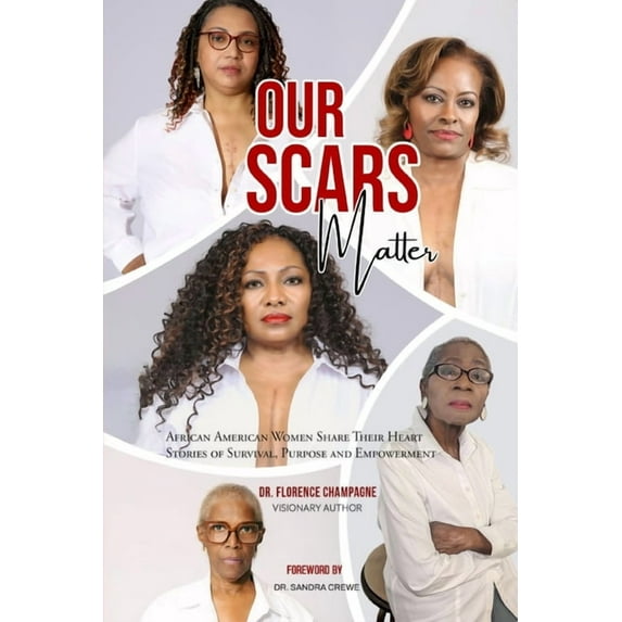 Our Scars Matter - African American Women Share Their Heart Stories of Survival, Purpose and Empowerment, (Paperback)