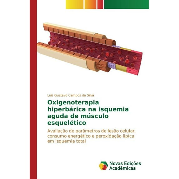 Oxigenoterapia hiperbárica na isquemia aguda de músculo esquelético (Paperback)