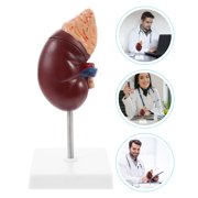 PENIKOKO 1Pc Human Body Model Kidney with Removable Parts Dark Brown for School and Laboratory Teaching