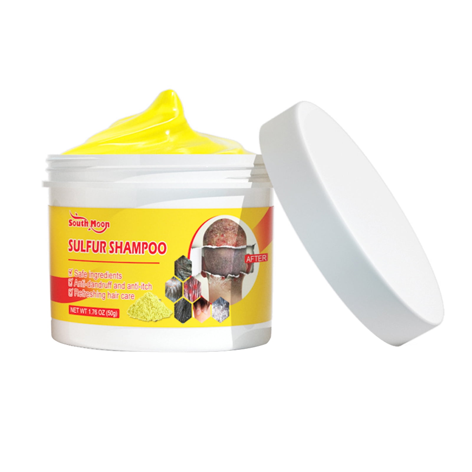 PERZOE 50g Sulfur Shampoo Fast Foam Lice Removal Nourishing Anti