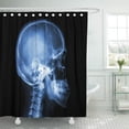 thumbnail image 1 of PKNMT Blue Film X Ray Skull and Cervical Spine Lateral Polyester Shower Curtain 60x72 inches, 1 of 1