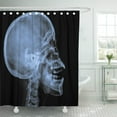 thumbnail image 1 of PKNMT Injury X Ray of Human Skull Jaw Anatomy Bone Polyester Shower Curtain 60x72 inches, 1 of 1