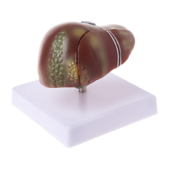 POYOGA Human Liver Pathological Anatomical Model Anatomy School Medical Teaching Displa