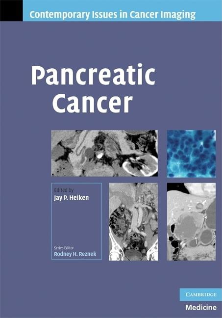 Pancreatic Cancer (Contemporary Issues in Cancer Imaging) - Heiken, Jay ...