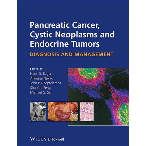 Pancreatic Cancer, Cystic Neoplasms and Endocrine Tumors: Diagnosis and Management, (Hardcover)