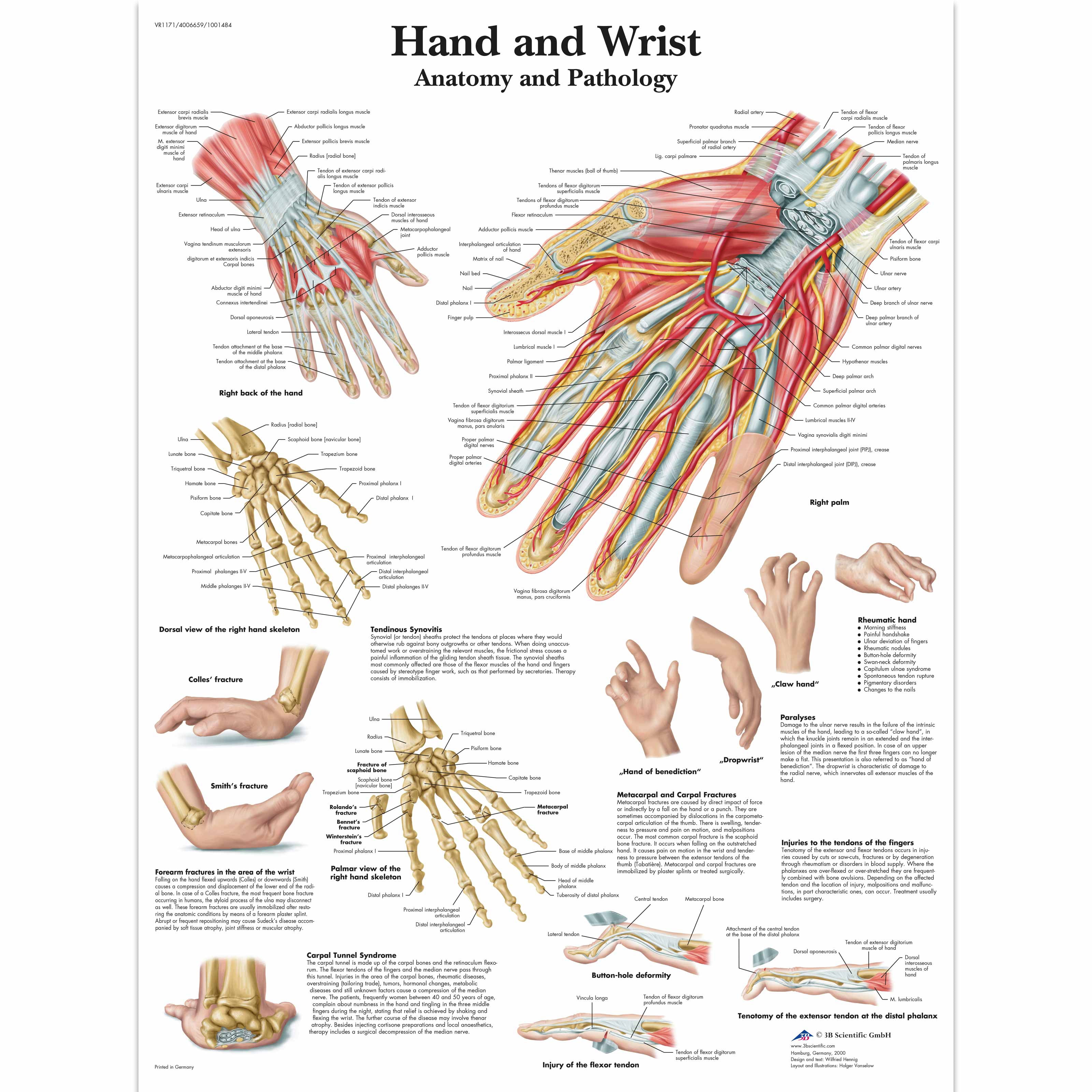 Paper Anatomical Charts - Hand and Wrist - 1 Each