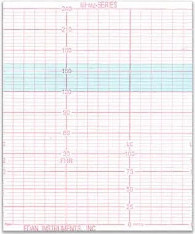 Paper-Cadence/Cadence II / MFM-2 Recorder Paper for Fetal Monitors ( 90mm×112mm×150p, US Standard). Box of (20) packs. (Bx/20)