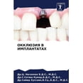 thumbnail image 1 of ОККЛЮЗИЯ В ИМПЛАНТАТАХ (Paperback), 1 of 1