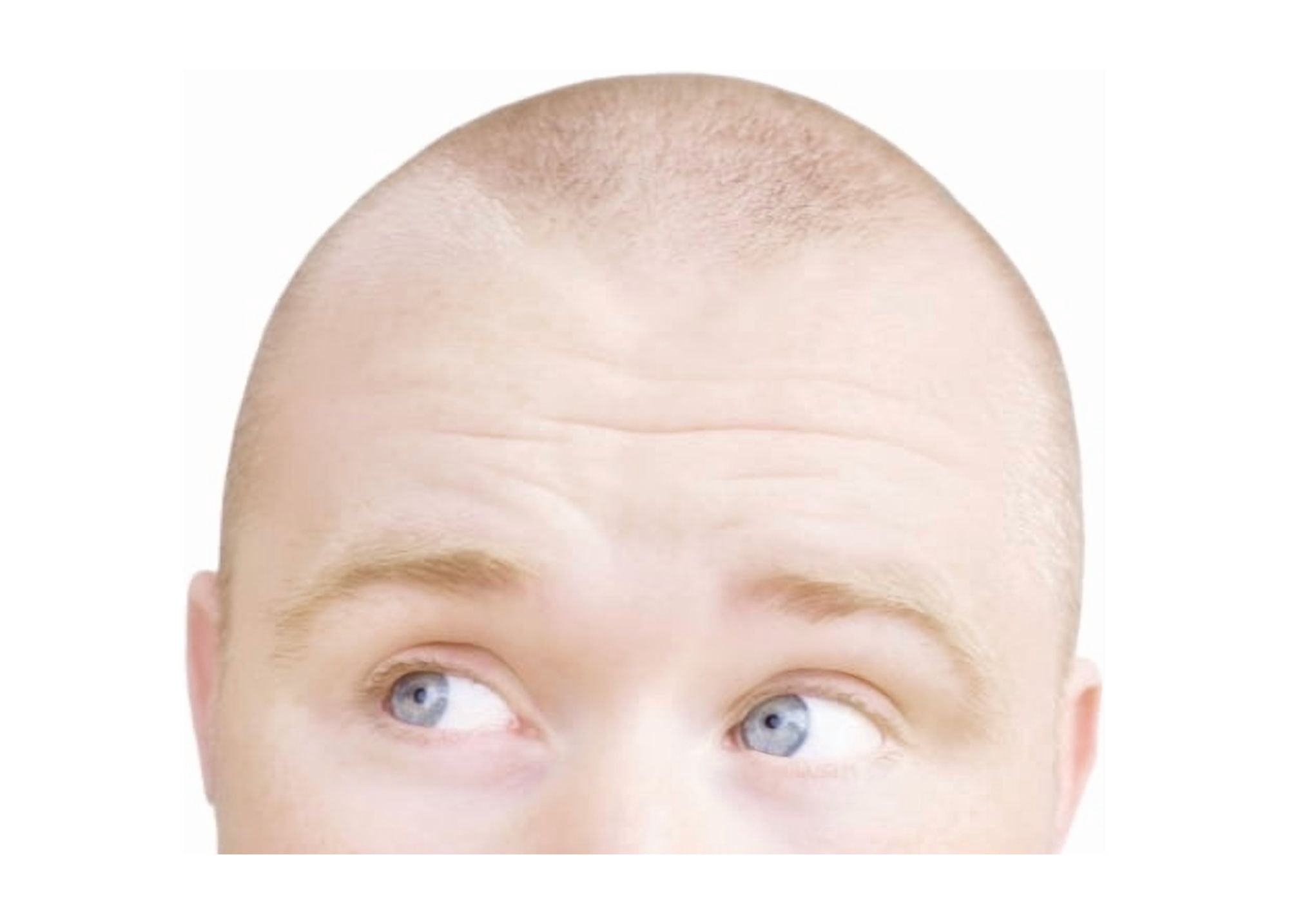 Part Of A Mans Head Looking Sideways Canvas Art - Chris and Kate Knorr  Design Pics (36 x 24)