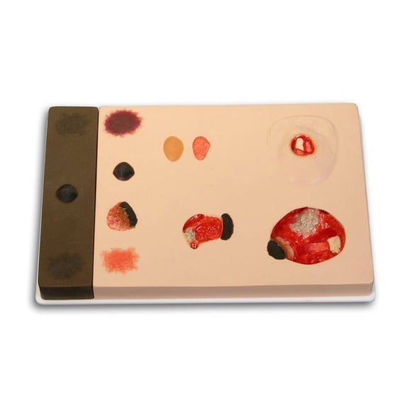 Pat Pressure Ulcer Model