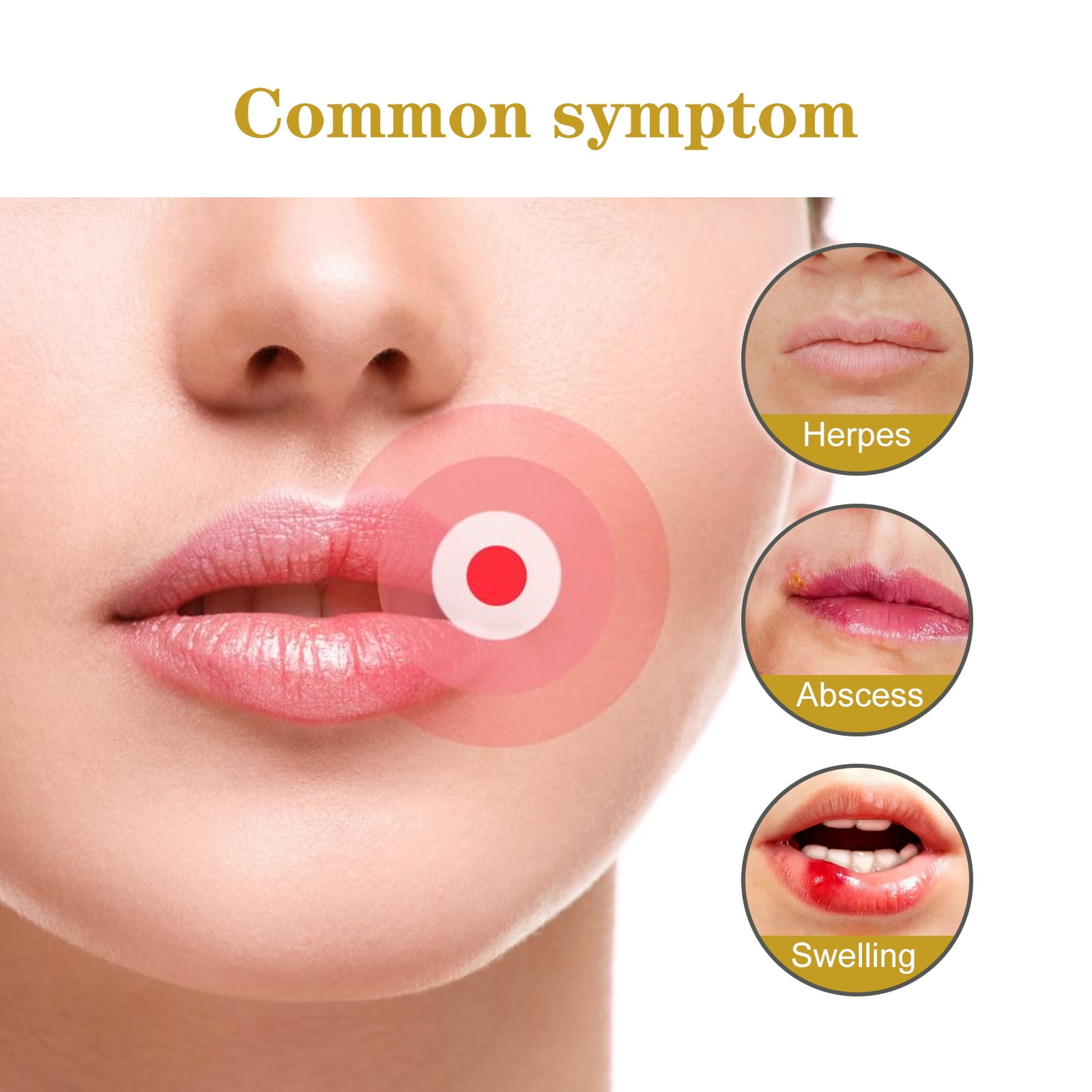 Patch,Blister Concealer Sores Blister Patch Blister Conceals Soothes